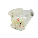 Complete Teeth Restoration Study with Dental Implant Model, Removable Bridge