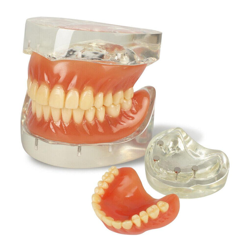 Dental Education with Removable Soft Gum Teeth Model - Perfect for Study, Demonstration and Standard Adult Teaching