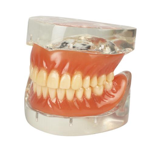 Dental Education with Removable Soft Gum Teeth Model - Perfect for Study, Demonstration and Standard Adult Teaching