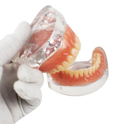 Dental Education with Removable Soft Gum Teeth Model - Perfect for Study, Demonstration and Standard Adult Teaching
