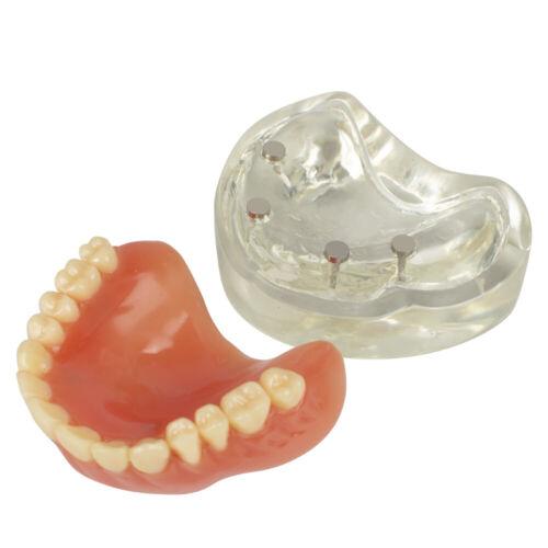 Dental Education with Removable Soft Gum Teeth Model - Perfect for Study, Demonstration and Standard Adult Teaching