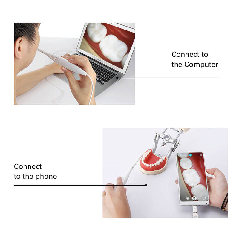 HD USB Oral Dental Intraoral Camera LED Light