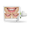 17 Inch 10 million pixels WIFI Digital LCD AIO Monitor Dental Intra oral Camera