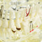 1pc Dental Implant Disease Teeth Model with Restoration & Bridge Tooth