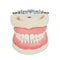 Dental Teach Study Adult Standard Typodont Demonstration Model Teeth