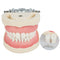 Dental Teach Study Adult Standard Typodont Demonstration Model Teeth