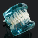 Dental Study Tooth Transparent Adult Pathological Teeth Model