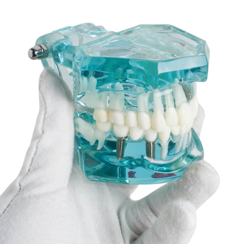Dental Study Tooth Transparent Adult Pathological Teeth Model