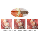 Dental Orthodontic Interproximal Enamel Reduction IPR Gauge Ruler 0.1-0.5 mm
