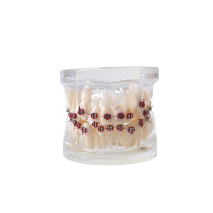 Dental Teach Study Adult Typodont Demonstration Teeth Model With Mental Brackets