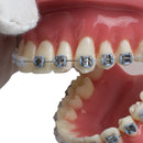 Dental Teeth Study Orthodontic Red Model with Metal and Ceramic Brackets