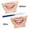Teeth Whitening Dental Bleaching System Oral Gel Kit Tooth Whitener