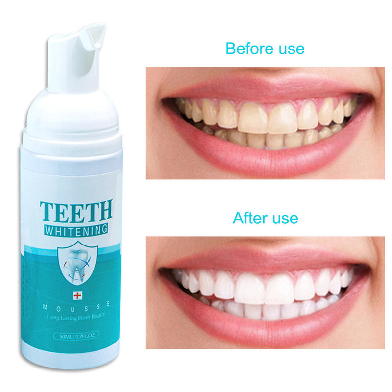 2pcs Teeth Whitening Foam Deep Cleansing For Adult