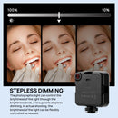 Dental Flash Photography Equipment Lighting Brightness