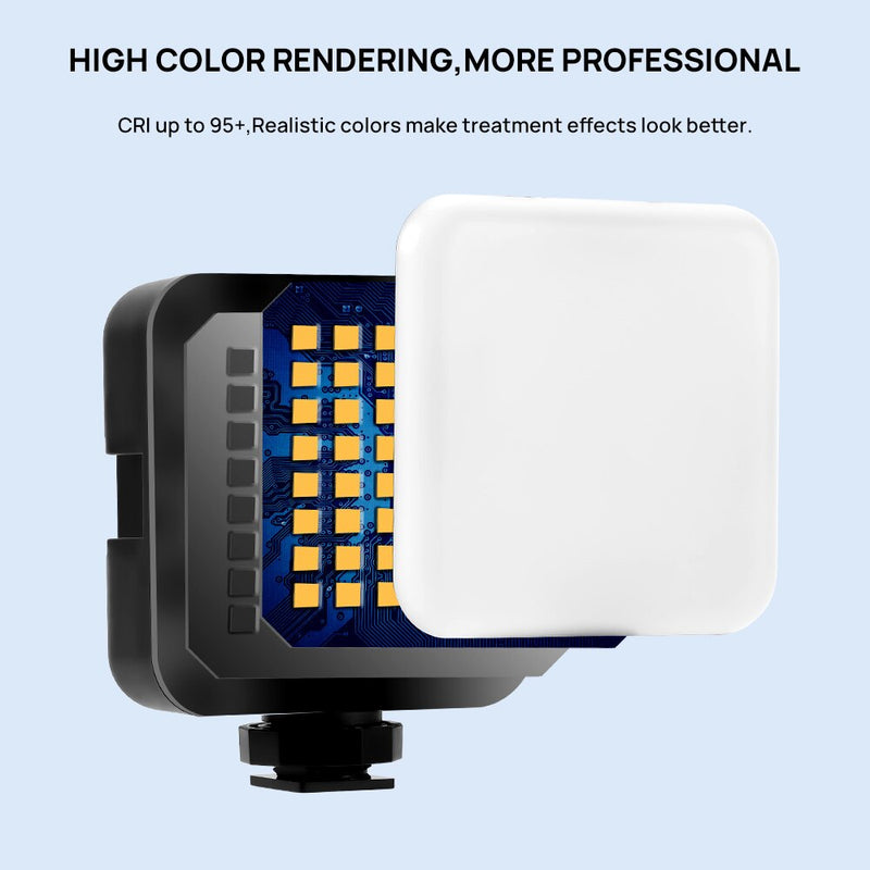 Dental Flash Photography Equipment Lighting Brightness