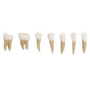 1: 1 28PCS Dental Implant Teeth Demonstration Teach Study Model