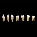 1: 1 28PCS Dental Implant Teeth Demonstration Teach Study Model